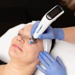 dermapen